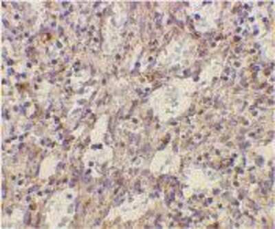 Immunohistochemistry-Paraffin: TLR2 Antibody [NBP1-77229] - Immunohistochemical analysis of TLR2 in human spleen cells using IMG-5651 at 2 ug/ml.