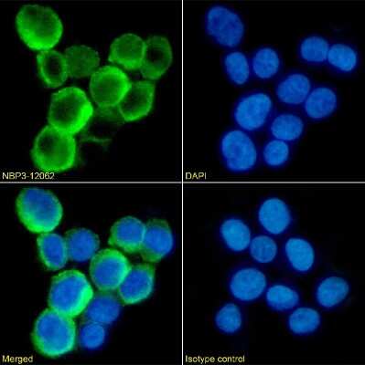 Immunocytochemistry/Immunofluorescence: TLR2 Antibody (TL2.1) - Chimeric [NBP3-12062] - Immunofluorescence analysis of paraformaldehyde fixed K562 cells on Shi-fix(TM) coverslips stained with the chimeric rabbit IgG version of TL2.1 (NBP3-12062) at 10 ug/ml for 1h followed by Alexa Fluor(R) 488 secondary antibody (2 ug/ml), showing membrane staining. The nuclear stain is DAPI (blue). Panels show from left-right, top-bottom NBP3-12062, DAPI, merged channels and an isotype control. The isotype control was an unknown specificity antibody followed by staining with Alexa Fluor(R) 488 secondary antibody.