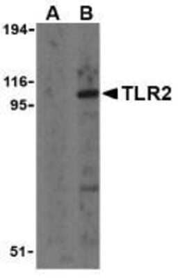 Western Blot: TLR2 Antibody [NBP1-77229] - A20 cell lysates with TLR2 antibody at 1 ug/ml in the presence (A) and absence (B) of its blocking peptide.
