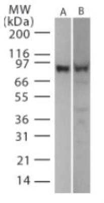 Western Blot: TLR2 Cell Lysate [NBP2-30165] - 15 ul of mouse TLR2  transfected cell lysate  tested with IMG-526 (A)  and IMG-662 (B).