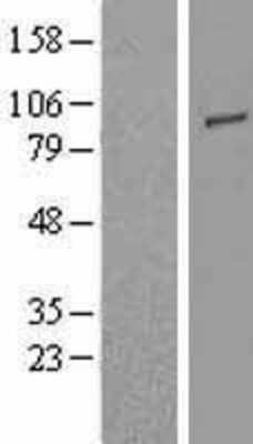 Western Blot: TLR2 Overexpression Lysate (Adult Normal) [NBL1-16952] Left-Empty vector transfected control cell lysate (HEK293 cell lysate); Right -Over-expression Lysate for TLR2.