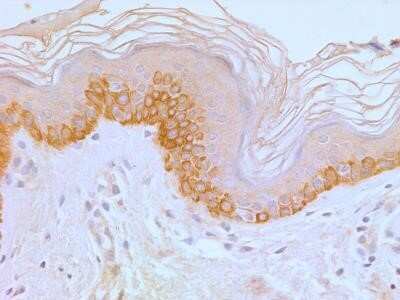 Immunohistochemistry: TLR4 Antibody (76B357.1) - Azide Free [NBP2-27149] - Tissue section of normal human skin stained with antibody at 5 ug/mL. Membrane-cytoplasmic immunopositivity of TLR4 was primarily observed in the pigmented basel cells and the adjacent keratinocytes in the epidermal layer. Image using the standard format of this product.