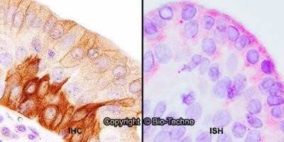 Immunohistochemistry-Paraffin: TLR4 Antibody (76B357.1) - Azide Free [NBP2-27149] - Formalin-fixed paraffin-embedded tissue sections of human tonsil were probed for TLR4 mRNA (ACD RNAScope Probe, catalog # 311281; Fast Red chromogen, ACD catalog # 322750). Adjacent tissue section was processed for immunohistochemistry using Mouse Monoclonal (Novus Biologicals catalog # NB100-56566) at 5ug/mL with 1 hour incubation at room temperature followed by incubation with anti-mouse IgG VisUCyte HRP Polymer Antibody (Catalog # VC001) and DAB chromogen (yellow-brown). Tissue was counterstained with hematoxylin (blue). Specific staining was localized to lymphocytes. Image using the standard format of this product.