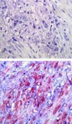 Immunohistochemistry-Paraffin: TLR4 Antibody (76B357.1) - Azide Free [NBP2-27149] - Analysis of TLR4 in paraffin-embedded formalin-fixed human colon tissue using an isotype control (top) and NB100-56566 (bottom) at 5 ug/mL. Image using the standard format of this product.