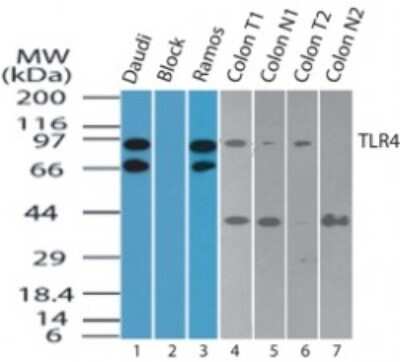 Western Blot: TLR4 Antibody [NBP2-24537] - Analysis of TLR4 in Daudi cell lysate in the (1) absence and (2) presence of immunizing peptide, (3) Ramos cell lysate, (4) human colon tumor lysate and (5) corresponding colon normal adjacent tissue lysate, (6) human colon tumor lysate and (7) corresponding colon normal adjacent tissue lysate. For the cell line testing, 2 ug/mL was used; for the colon lysate, 5 ug/mL was used.