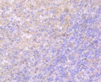Immunohistochemistry-Paraffin: TLR5 Antibody (JM10-88) [NBP2-67205] - Analysis of paraffin-embedded human spleen tissue using anti-TLR5 antibody. Counter stained with hematoxylin.