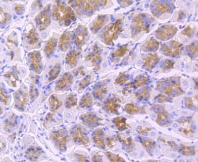 Immunohistochemistry-Paraffin: TLR5 Antibody (JM10-88) [NBP2-67205] - Analysis of paraffin-embedded mouse stomack tissue using anti-TLR5 antibody. Counter stained with hematoxylin.