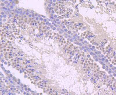 Immunohistochemistry-Paraffin: TLR5 Antibody (JM10-88) [NBP2-67205] - Analysis of paraffin-embedded mouse testis tissue using anti-TLR5 antibody. Counter stained with hematoxylin.