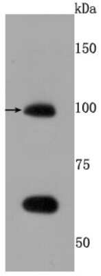 Western Blot: TLR5 Antibody (JM10-88) [NBP2-67205] - Analysis of TLR5 on Hela cells lysates using anti-TLR5 antibody at 1/500 dilution.