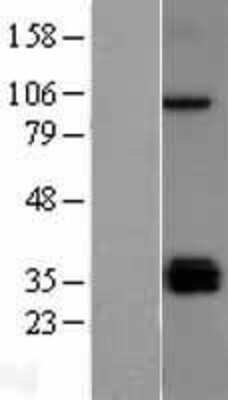 Western Blot TLR5 Overexpression Lysate