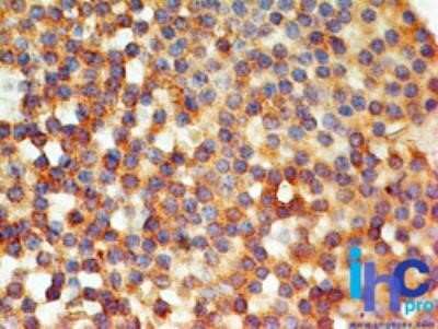 Immunohistochemistry: TLR6 Antibody (86B1153.2) - Azide Free [NBP2-37704] - Tonsil probed with TLR6 antibody at 5 ug/ml. Novus's human tissue TMA was used for this test. Staining of formalin-fixed tissues is enhanced by boiling tissue sections in 10 mM sodium citrate buffer, pH 6.0 for 10-20 min followed by cooling at RT for 20 m