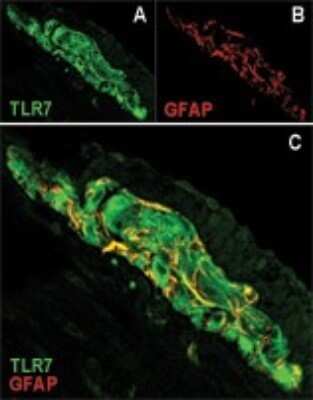 Immunocytochemistry/Immunofluorescence: TLR7 Antibody - Azide Free [NBP2-24905] - Immunolocalization of TLR7 (A) and glial fibrillary acidic protein (GFAP) (B) in murine myenteric plexus. Most of the GFAP positive cells were also positive for TLR7 in the merged image (C, yellow staining). (Courtesy of Barajon I, et al., Journal of Histochemistry and Cytochemistry, 57(11): 1013-;1023, 2009.) Image using the standard format of this product.