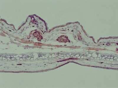 Immunohistochemistry-Frozen: TLR7 Antibody - Azide Free [NBP2-24905] - Analysis of frozen mouse ear skin tissue using anti-TLR7 antibody. Image from verified customer review. Image using the standard format of this product.