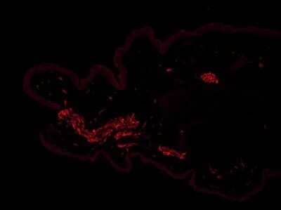 Immunohistochemistry-Frozen: TLR7 Antibody - Azide Free [NBP2-24905] - Analysis of TLR7 in acetone-fixed, frozen mouse ear skin section using anti-TLR7 antibody. Image from verified customer review. Image using the standard format of this product.