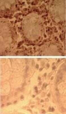 Immunohistochemistry-Paraffin: TLR7 Antibody - Azide Free [NBP2-24905] - Analysis of human colon tissue using NBP2-24905 (top) and an isotype control (bottom) at 5 ug/ml.