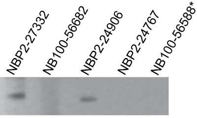 Western Blot: TLR7 Antibody (4G6) - Azide Free [NBP2-25274] - TLR7 antibodies tested at 2 ug/ml on recombinant partial hTLR7 protein (amino acids 562-839).  NB100-56682 and NBP2-24767 immunogen sequences are not present in recombinant protein; *NB100-56588 is not recommended for use in western blot.
