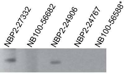 Western Blot: TLR7 Antibody (4G6) - Azide and BSA Free [NBP2-80982] - TLR7 antibodies tested at 2 ug/ml on recombinant partial hTLR7 protein (amino acids 562-839). NB100-56682 and NBP2-24767 immunogen sequences are not present in recombinant protein; *NB100-56588 is not recommended for use in western blot. Image using the standard format of this product.