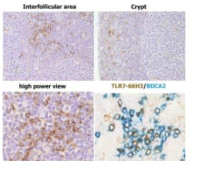 Immunohistochemistry: TLR7 Antibody (66H3) [DDX0500P-100] - IHC staining of human FFPE tonsil section(Vermi William courtesy)