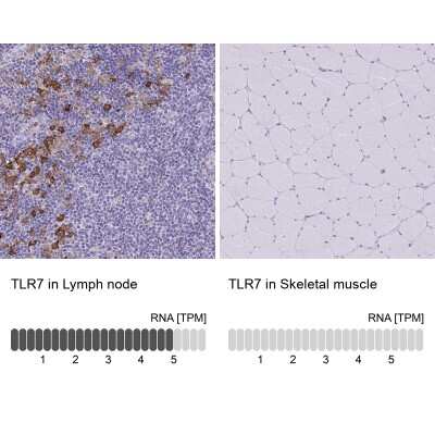 Immunohistochemistry-Paraffin: TLR7 Antibody [NBP2-32483] - Analysis in human lymph node and skeletal muscle tissues using NBP2-32483 antibody. Corresponding TLR7 RNA-seq data are presented for the same tissues.