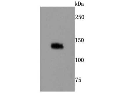 Western Blot: TLR7 Antibody (JA93-11) [NBP2-67209] - Analysis of TLR7 on Daudi cells lysates using anti-TLR7 antibody at 1/500 dilution.