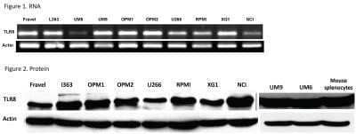 Western Blot: TLR8 Antibody (44C143) - Azide Free [NBP2-77073] - All the cell lines expressed mRNA for TLR8 (Figure 1) and displayed a strong expression of TLR8 protein (Figure 2). Lysates of human intestinal tissue and mouse splenocytes were used as positive controls. Beta-actin was served as loading control and was used to normalize expression levels between cells. Data are representative for analysis of >=2 independent experiments. Image collected and cropped by CiteAb from the following publication (//doi.org/10.1371/journal.pone.0060671) licensed under a CC-BY license. Image from the standard format of this antibody.