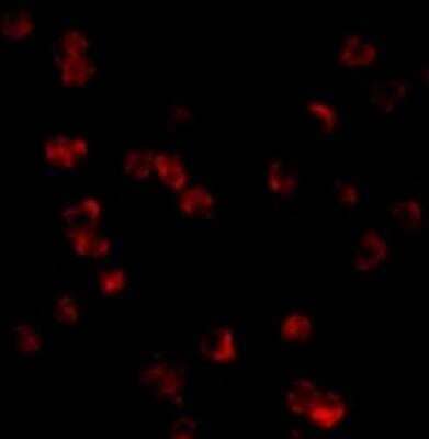 Immunocytochemistry/Immunofluorescence: TLR8 Antibody [NBP1-77203] - Daudi cells at 10 ug/ml