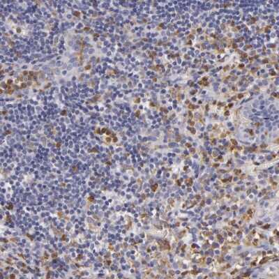 <b>Orthogonal Strategies Validation. </b>Immunohistochemistry-Paraffin: TLR8 Antibody [NBP1-85767] - Staining of human appendix shows high expression.