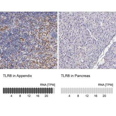 Immunohistochemistry-Paraffin: TLR8 Antibody [NBP1-85767] - Staining in human appendix and pancreas tissues using anti-TLR8 antibody. Corresponding TLR8 RNA-seq data are presented for the same tissues.