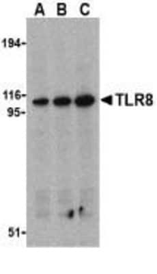 Western Blot: TLR8 Antibody [NBP1-77203] - Daudi cell lysates with TLR8 antibody at (A) 0.5, (B) 1, and (C) 2 ug/ml.