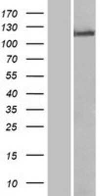 Western Blot: TLR8 Overexpression Lysate (Adult Normal) [NBP2-05618] Left-Empty vector transfected control cell lysate (HEK293 cell lysate); Right -Over-expression Lysate for TLR8.