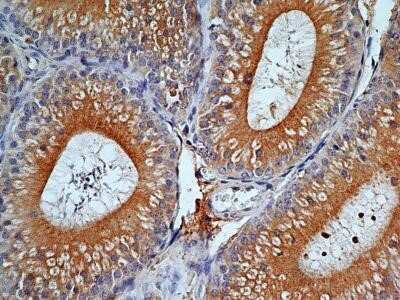 Immunohistochemistry: TLR9 Antibody (2A4C6.2E5) - Azide and BSA Free [NBP2-80983] - Analysis of TLR9 protein in normal mouse epididymis section using TLR9 antibody (clone 2E5) at a concentration of 5 ug/mL. This antibody developed strong cytoplasmic staining in the pseudostratified columnar epithelial cells as well as the blood vessels o