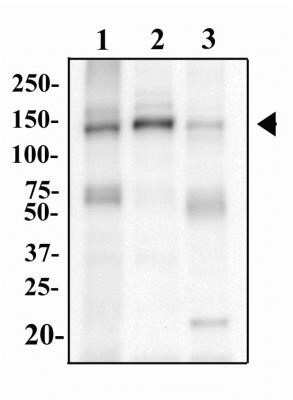 Western Blot: TLR9 Antibody (2A4C6.2E5) - Azide and BSA Free [NBP2-80983] - Mouse Liver (lane 1), Mouse Kidney (lane 2) and Mouse Spleen (lane 3) were separated by SDS-PAGE and the protein transferred to PVDF. The membrane was then probed with anti-TLR9 at 2ug/mL and detected with an anti-rat HRP secondary antibody using chemiluminescence. Image from the standard format of this antibody.