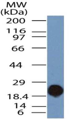 Western Blot: TLR9 Antibody (2A4C6.2E5) - Azide and BSA Free [NBP2-80983] - WB analysis of partial recombinant TLR9 protein (expected molecular weight ~21kDa) with TLR9 antibody (clone 2A4C6.2E5) at a concentration of 2 ug/mL. Image from the standard format of this antibody.