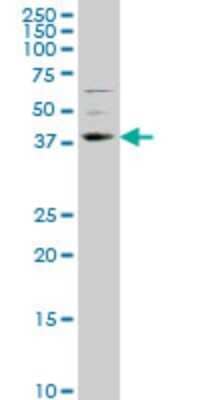 Western Blot: TLX/NR2E1 Antibody (1C4) [H00007101-M01] - NR2E1 monoclonal antibody (M01), clone 1C4 Analysis of NR2E1 expression in NIH/3T3.