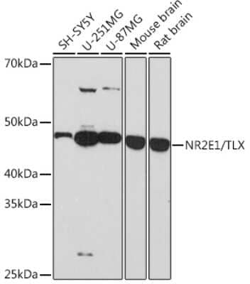 Western Blot: TLX/NR2E1 Antibody (6P3H8) [NBP3-16504] - Western blot analysis of extracts of various cell lines, using TLX/NR2E1 Rabbit mAb (NBP3-16504) at 1:1000 dilution. Secondary antibody: HRP Goat Anti-Rabbit IgG (H+L) at 1:10000 dilution. Lysates/proteins: 25ug per lane. Blocking buffer: 3% nonfat dry milk in TBST. Detection: ECL Basic Kit. Exposure time: 3min.