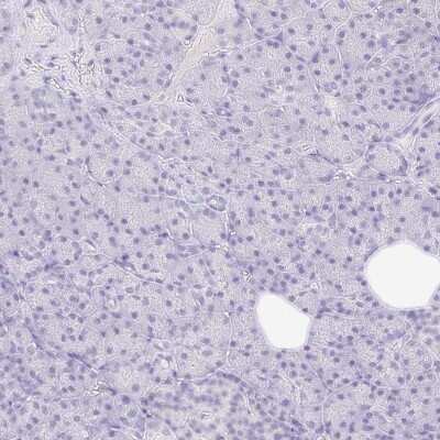 <b>Orthogonal Strategies Validation. </b>Immunohistochemistry-Paraffin: TLX/NR2E1 Antibody [NBP2-38764] - Staining of human pancreas shows low expression as expected.