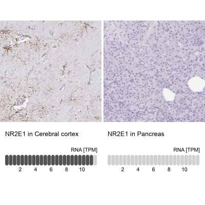 Immunohistochemistry-Paraffin: TLX/NR2E1 Antibody [NBP2-38764] - Staining in human cerebral cortex and pancreas tissues using anti-NR2E1 antibody. Corresponding NR2E1 RNA-seq data are presented for the same tissues.