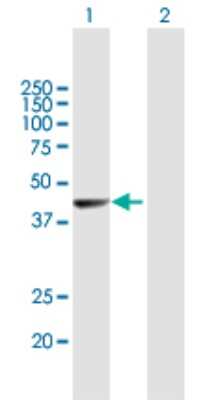 Western Blot: TLX/NR2E1 Antibody [H00007101-B01P] - Analysis of NR2E1 expression in transfected 293T cell line by NR2E1 polyclonal antibody.  Lane 1: NR2E1 transfected lysate(42.35 KDa). Lane 2: Non-transfected lysate.