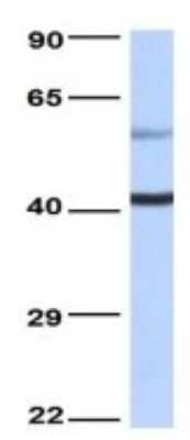 Western Blot: TLX/NR2E1 Antibody [NBP3-10924] - Western blot analysis of TLX/NR2E1 in Human Fetal Heart. Antibody dilution at 1.0ug/ml