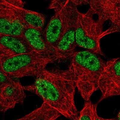 Immunocytochemistry/Immunofluorescence: TLX2 Antibody [NBP2-56470] - Staining of human cell line SH-SY5Y shows localization to nucleoplasm.