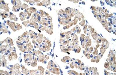 Immunohistochemistry: TLX2 Antibody [NBP2-85926] - Human Muscle