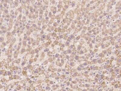 Immunohistochemistry-Paraffin: TLX2 Antibody [NBP2-98149] - Immunochemical staining of human TLX2 in human liver with rabbit polyclonal antibody at 1:100 dilution, formalin-fixed paraffin embedded sections.