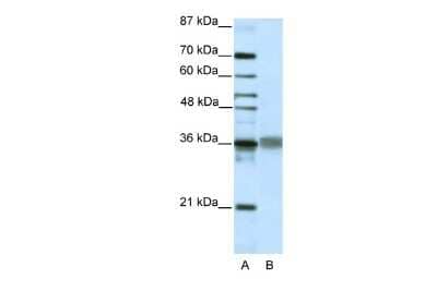 Western Blot: TLX2 Antibody [NBP2-85926] - WB Suggested Anti-TLX2 Antibody Titration: 2.5ug/ml. ELISA Titer: 1:312500. Positive Control: HepG2 cell lysate