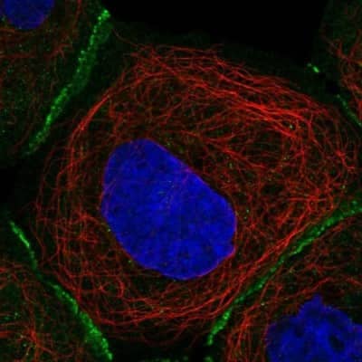 Immunocytochemistry/Immunofluorescence: TM14 Antibody [NBP1-92512] - Staining of human cell line A-431 shows localization to plasma membrane & cell junctions. Antibody staining is shown in green.