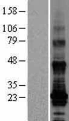 Western Blot: TM4SF19 Overexpression Lysate (Adult Normal) [NBL1-16964] Left-Empty vector transfected control cell lysate (HEK293 cell lysate); Right -Over-expression Lysate for TM4SF19.