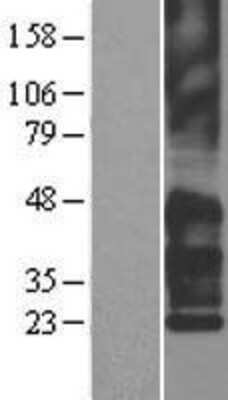 Western Blot: TM4SF2 Overexpression Lysate (Adult Normal) [NBL1-17381] Left-Empty vector transfected control cell lysate (HEK293 cell lysate); Right -Over-expression Lysate for TM4SF2.