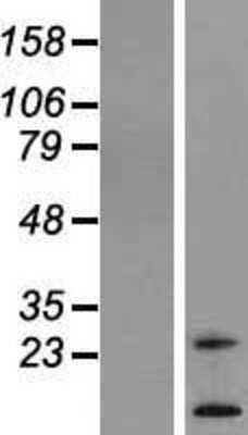 Western Blot: TM4SF20 Overexpression Lysate (Adult Normal) [NBL1-16965] Left-Empty vector transfected control cell lysate (HEK293 cell lysate); Right -Over-expression Lysate for TM4SF20.
