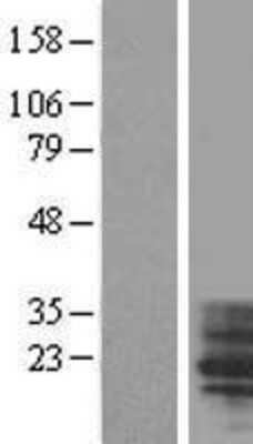 Western Blot: TM4SF4 Overexpression Lysate (Adult Normal) [NBL1-16966] Left-Empty vector transfected control cell lysate (HEK293 cell lysate); Right -Over-expression Lysate for TM4SF4.