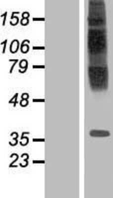 Western Blot TM6SF1 Overexpression Lysate