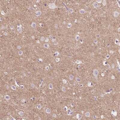 Immunohistochemistry-Paraffin: TM6SF2 Antibody [NBP2-49469] - Staining of human cerebral cortex shows weak positivity in neuropil.